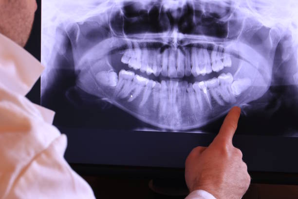 Best Pediatric Emergency Dentist in Williston, SC